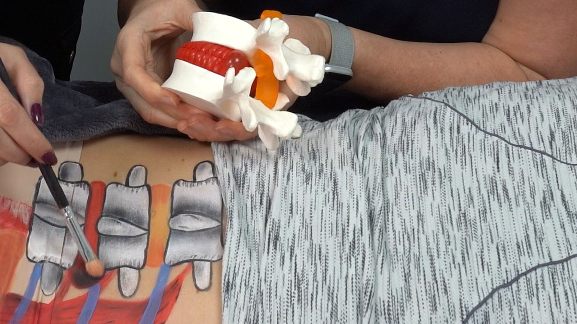 Sciatica Explained and Treatments (blog and video)